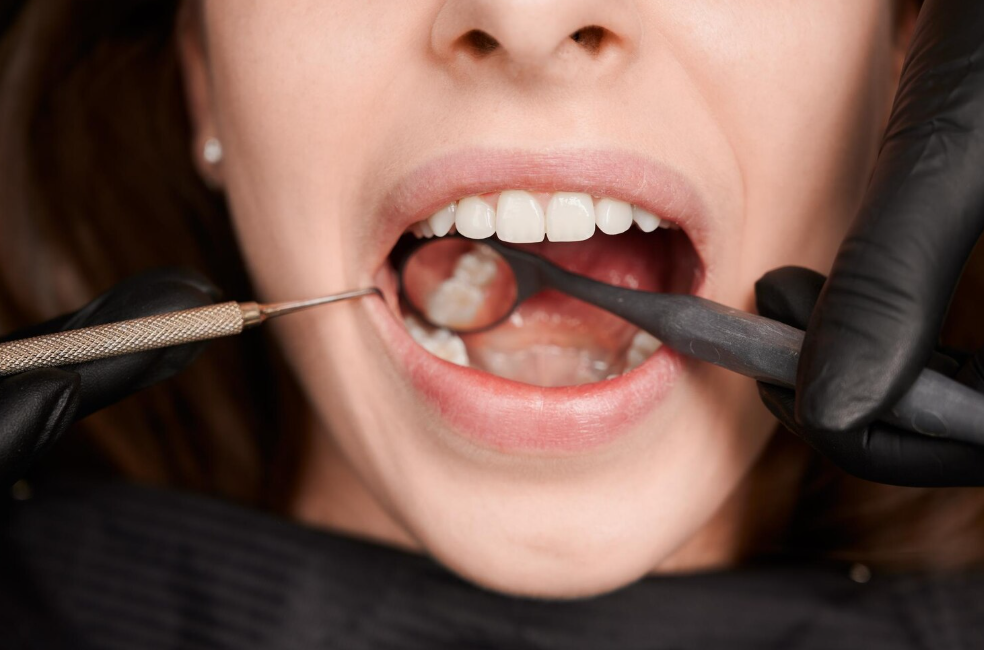 Periodoncia en Valladolid